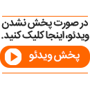 عمل لیفت شقیقه و مزایای آن