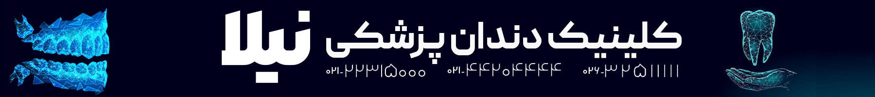 افزایش تقاضای ایمپلنت دندان در تهران و کرج