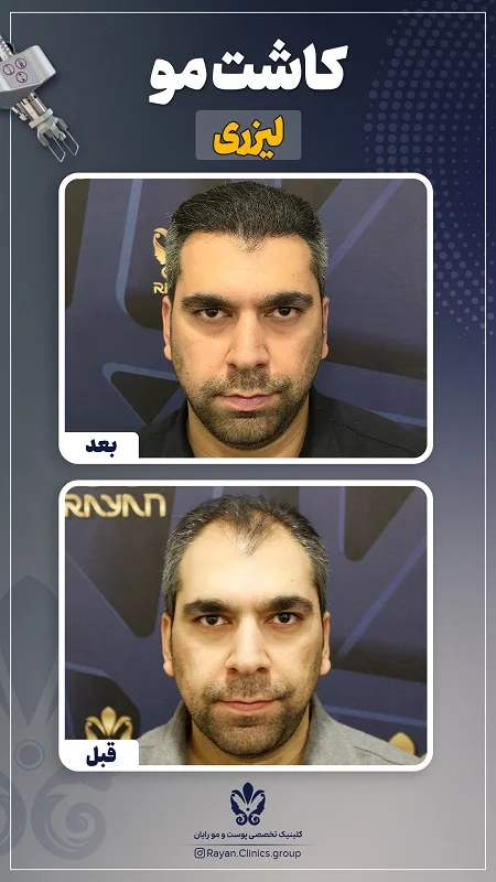 Before After Farsi L - 9