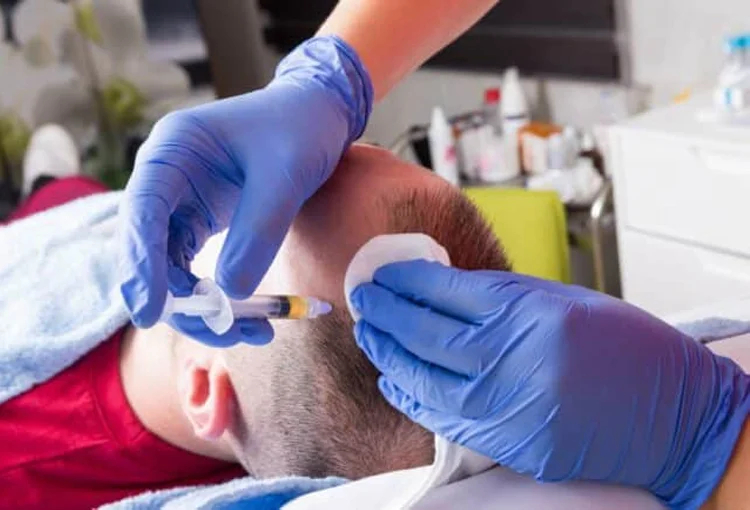 تاثیرات پی آر پی پس از کاشت مو
