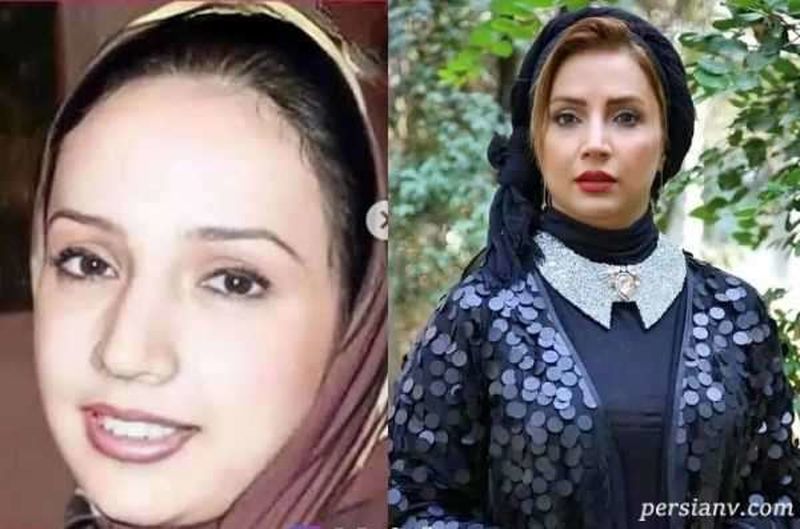 بازیگرانی که زیباتر شدند